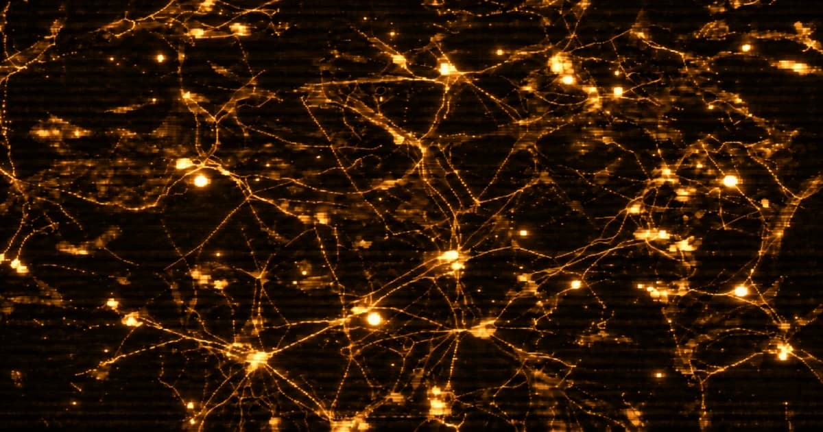 Dense microscopic network of branching neurons and fine interconnected filaments, with scattered bright cell bodies across a dark background.